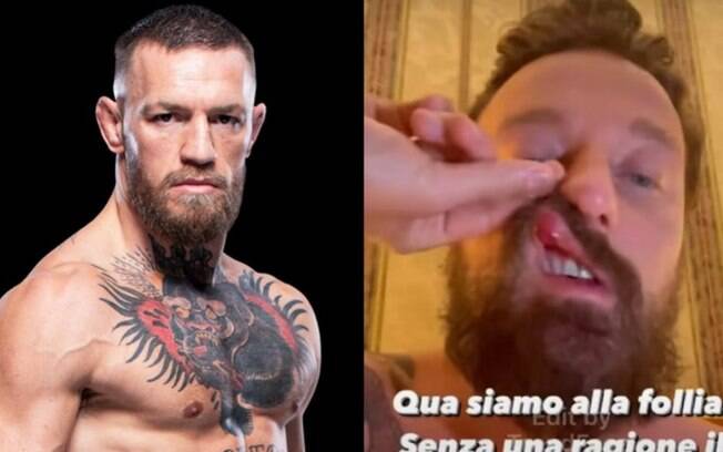 DJ italiano publica vídeo com marcas de uma suposta agressão de Conor McGregor: 'Violento e perigoso'