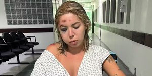 Passageira é atropelada por motorista de app após negar dinheiro