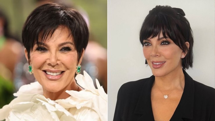 Kris%20Jenner%2020%20anos%20mais%20jovem%3F%20Entenda%20a%20medicina%20regenerativa
