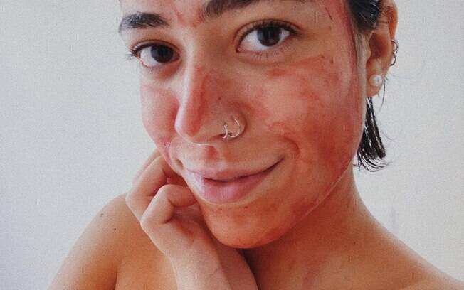 Luisa Moraleida usa sangue da menstruação como máscara facial
