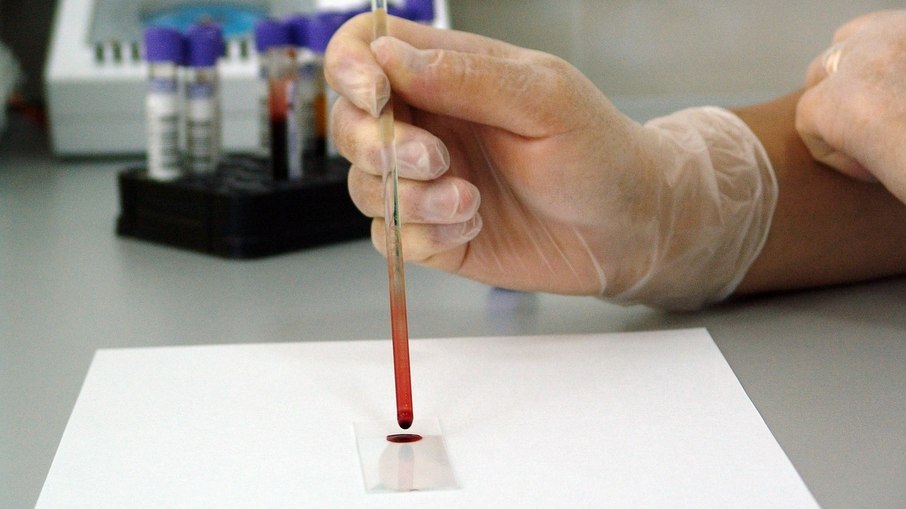 Anvisa aprova novo teste para detectar febre maculosa