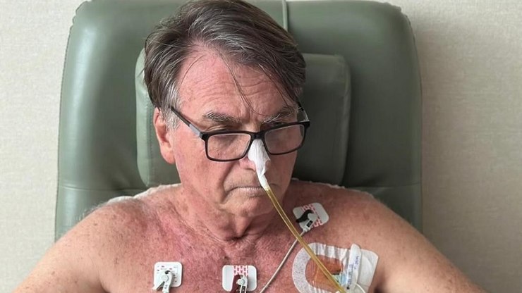Bolsonaro segue na UTI com boa evolução clínica, diz
boletim