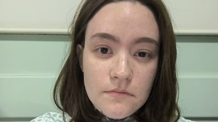 Mineira com “pior dor do mundo” tenta alívio com sedação