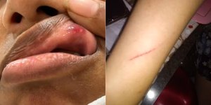 Pedidos de pizza e dipirona viram alerta de agressão à mulher