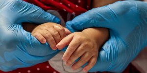 Atrofia Muscular Espinhal: conheça a doença, os tipos e sintomas