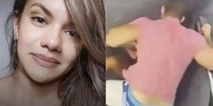 Mulher espancada com 61 socos mostra o rosto após cirurgias