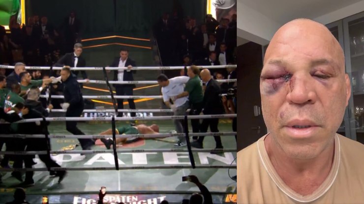 Wanderlei Silva preocupa fãs em atualização do estado de saúde