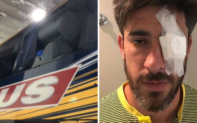 Ônibus do Boca Juniors foi apedrejado e capitão Pablo Pérez ficou ferido; clube pediu que partida fosse suspensa e Conmebol acatou