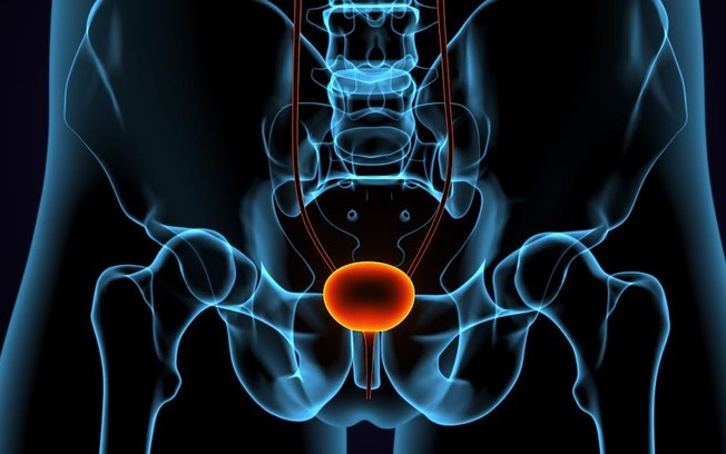 Urologista explica diferenças entre HPB e câncer de próstata Urologista explica diferenças entre HPB e câncer de próstata