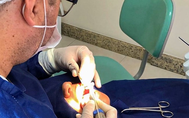 Mercado de implantes deve chegar a R$ 72 milhões em 2027