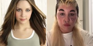 Amanda Bynes é novamente internada em clínica psiquiátrica