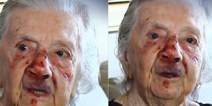 Idosa de 93 anos é agredida durante assalto