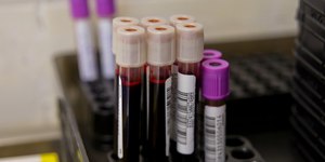 Caso suspeito de Ebola é investigado no Rio Grande do Sul