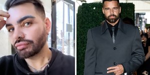 Homem passa por 30 cirurgias para ficar parecido com Ricky Martin	