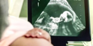 Gestação sem embrião: do diagnóstico ao aborto