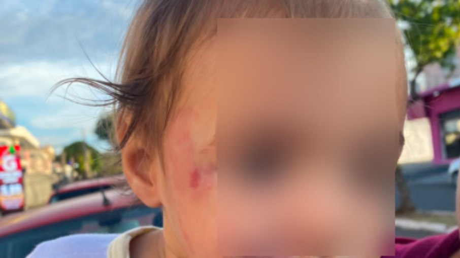 Uma tomografia indicou que os ferimentos eram compatíveis com agressões
