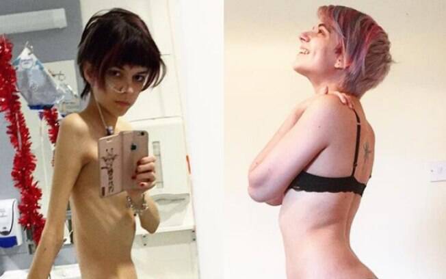 Connie publica fotos no Instagram para encorajar as mulheres a amarem seus corpos e conta sobre sua luta com anorexia