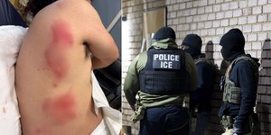 Agentes dos EUA teriam usado cão para atacar e deter imigrante