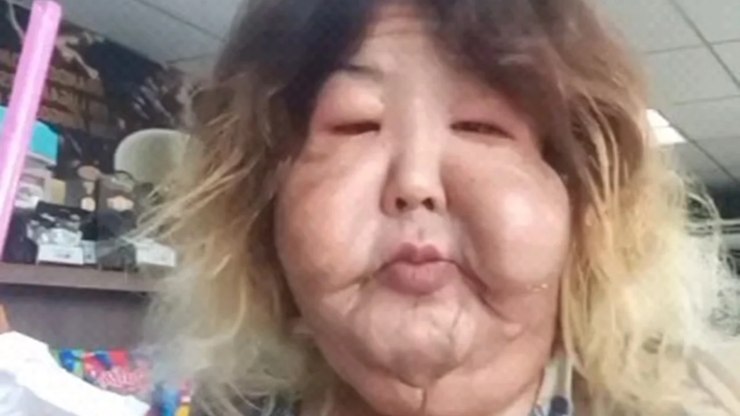 M%C3%A9dico%20detalha%20cirurgia%20de%20Juju%20do%20Pix%3B%20veja%20antes%20e%20depois