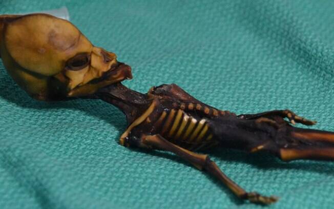 Cientistas americanos descobrem que 'Ata, a alien' é um feto humano que morreu durante gestação há mais de 40 anos