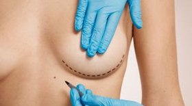 10 dicas para uma cirurgia de mama bem-sucedida