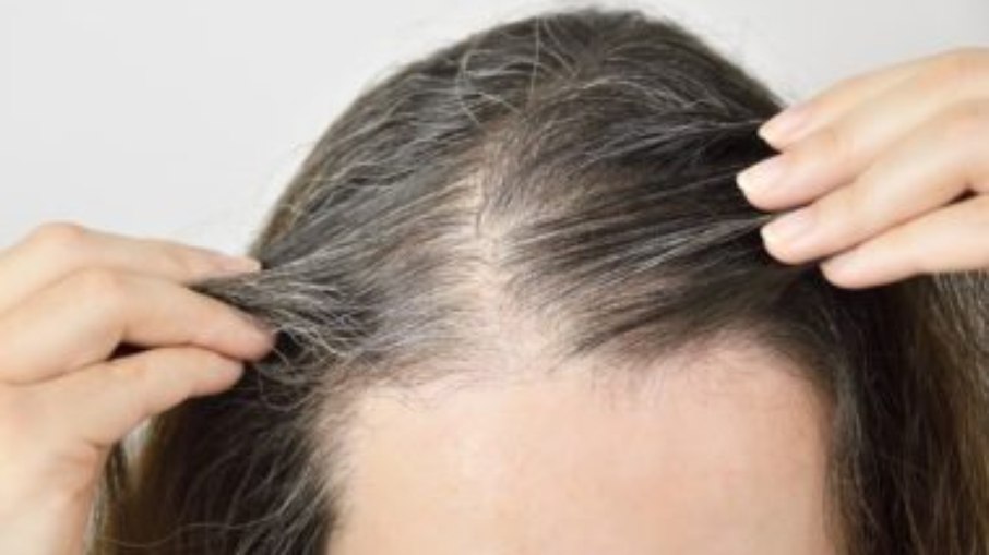 É comum perder muito cabelo após a gestação?
