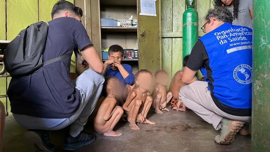 Crianças Yanomami com desnutrição severa são atendidos por equipes do Ministério da Saúde 
