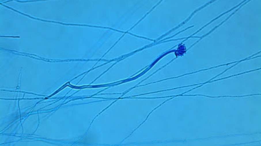 Aspergillus calidoustus