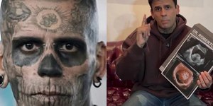 "Homem mais tatuado do Brasil" descobre tumor na bexiga