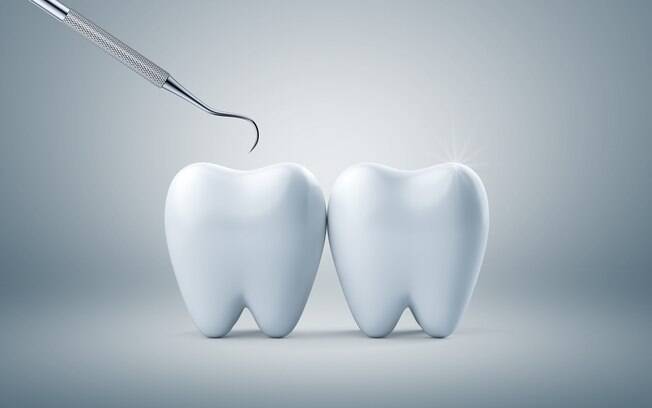 Fatores que podem ocasionar na fratura dos dentes