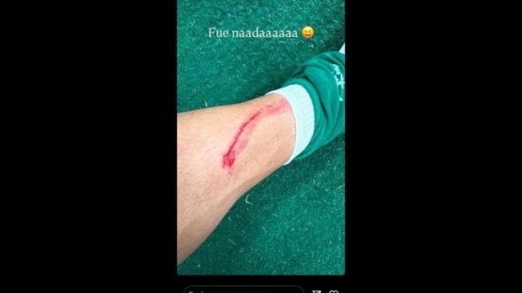 Palmeiras vai enviar reclamação a FPF por lance em Flaco López
