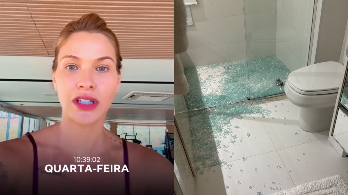 Andressa Suita sofre acidente doméstico e leva pontos; entenda