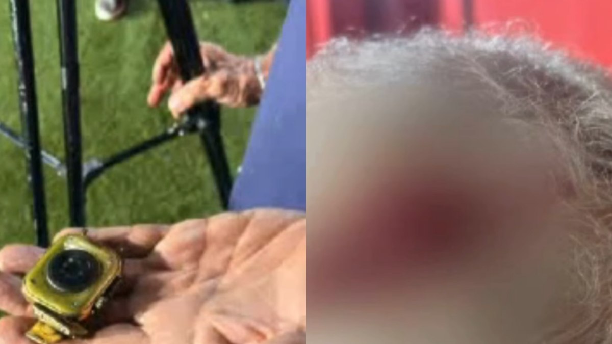 Cinegrafista da TV Bahia é ferido durante transmissão de clássico