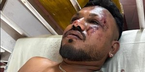 Quem é o único sobrevivente do voo da Air India?