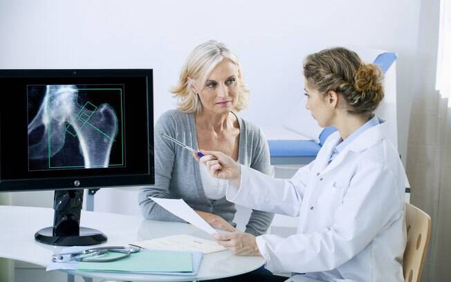 Osteoporose causa fragilidade dos ossos e atinge principalmente as mulheres