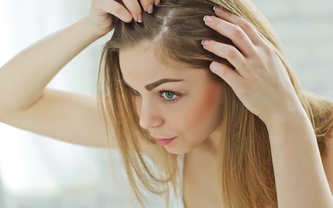 Entenda como a síndrome do ovário policístico causa a queda de cabelos
