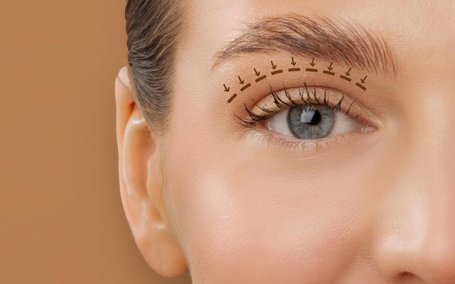 Blefaroplastia envolve função ocular além da estética