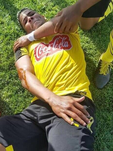 Gil Bahia%2C jogador brasileiro%2C levou uma pedrada durante partida na Tunísia Gil Bahia, jogador brasileiro, levou uma pedrada durante partida na Tunísia