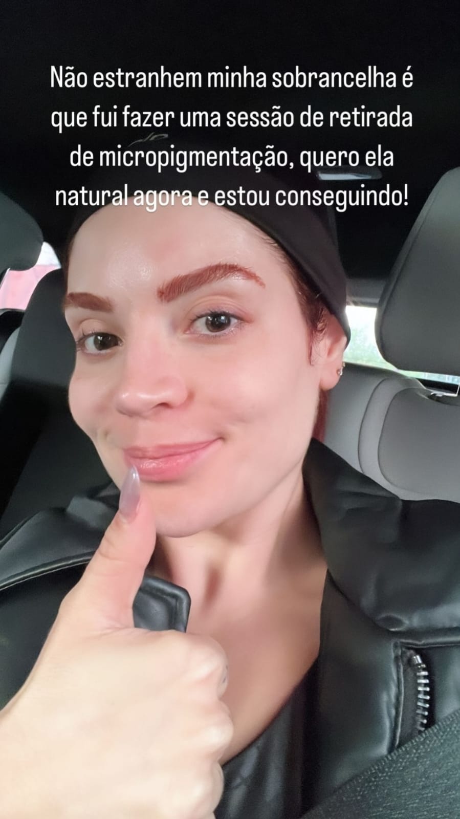 Gkay revela remoção de procedimento estético: 'quero natural' Reprodução/Instagram