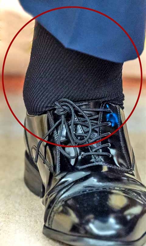 Outros sintomas possíveis são sensação de peso, dor ou queimação nas pernas Reprodução: Flipar