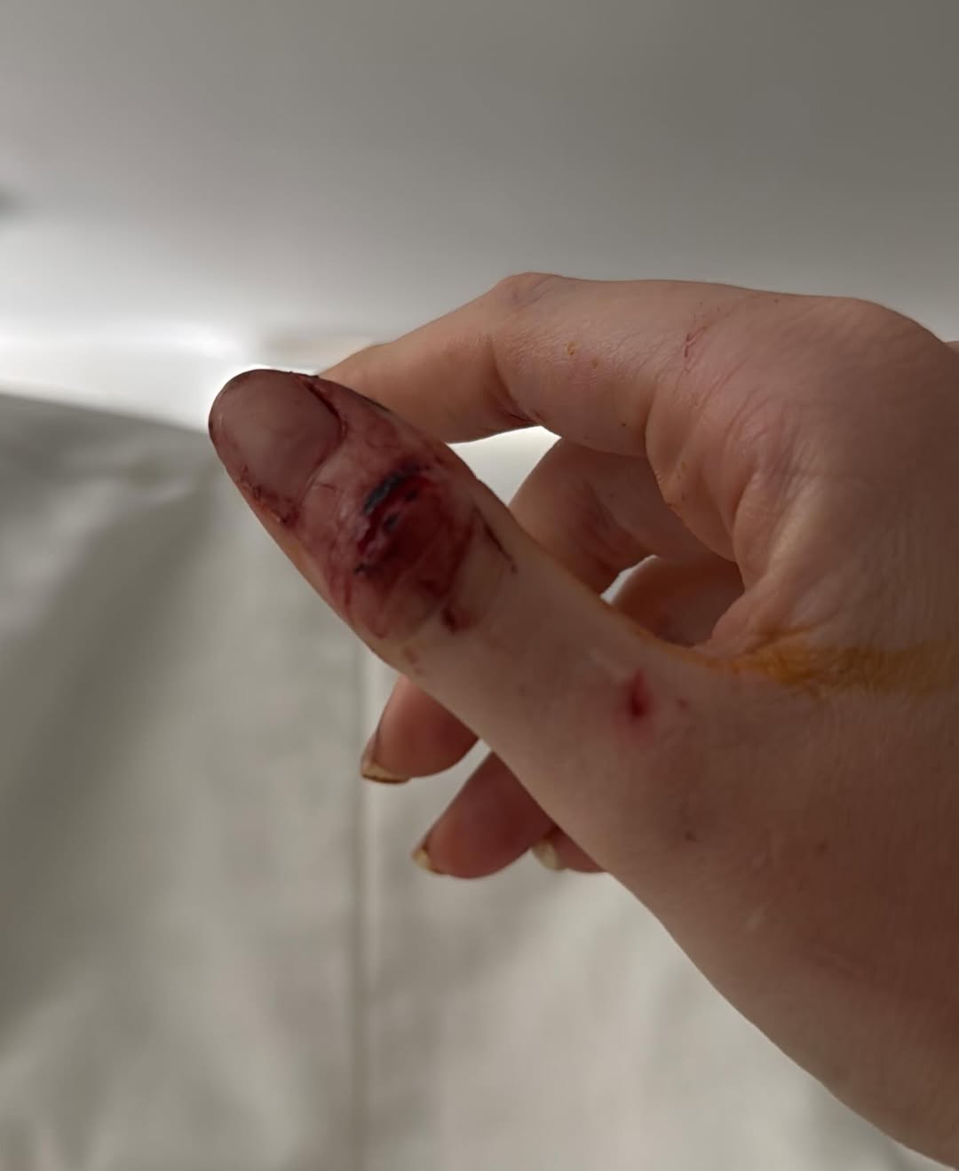 Marcela Tomaszewski postou prints e fotos de supostas agressões. Foto: Reprodução/ Instagram @tomaszewsk