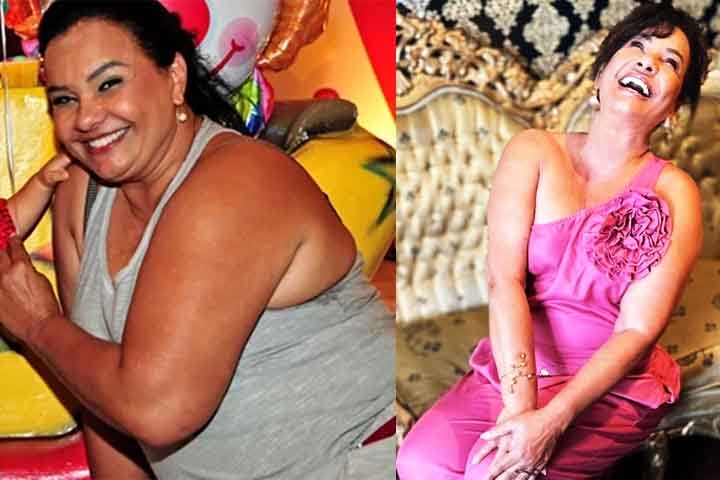 Solange Couto, - Em 2013, a atriz, então com 56 anos, decidiu realizar uma cirurgia de redução do estômago, conseguindo eliminar cerca de 40 quilos e passar do manequim 54 para o 42 em apenas dois meses. 
 Reprodução: Flipar