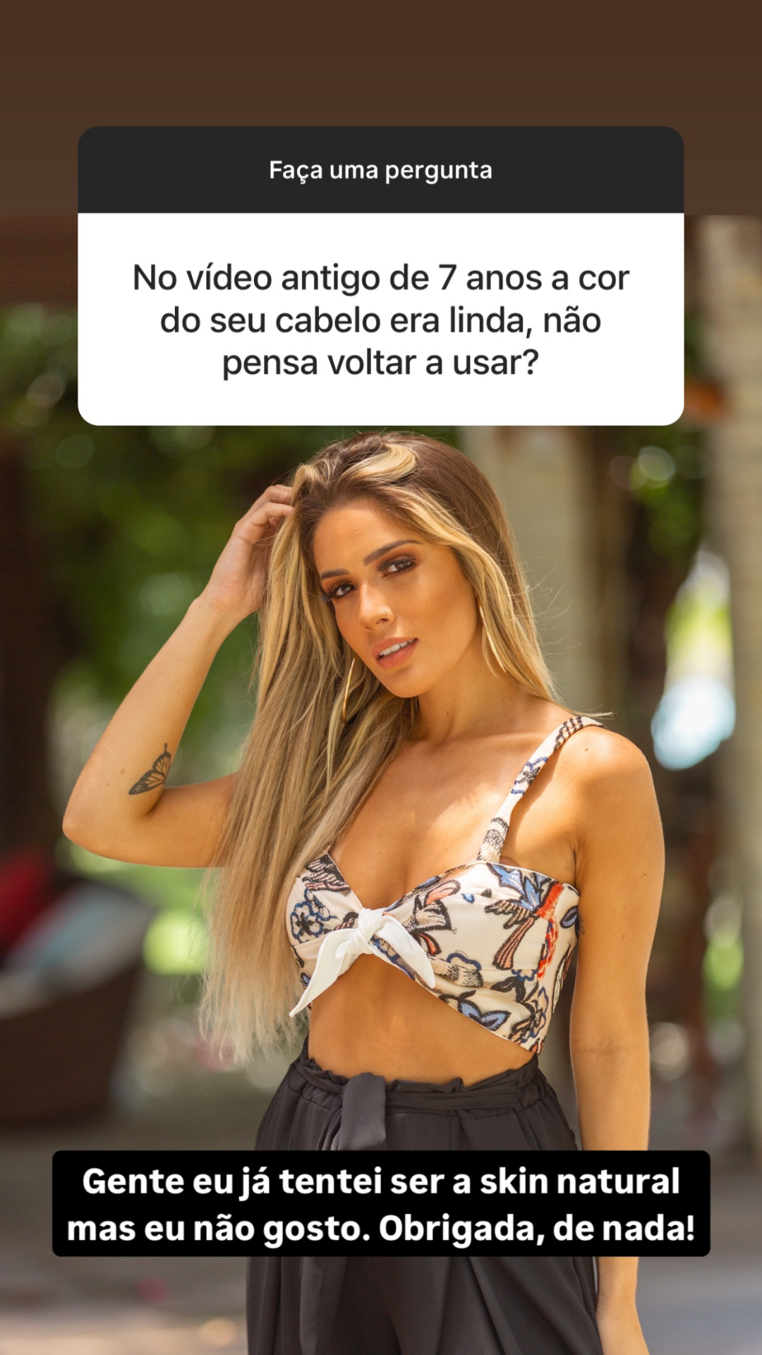 Karoline Lima surpreende com antes e depois dos procedimentos estéticos; veja Reprodução/Instagram