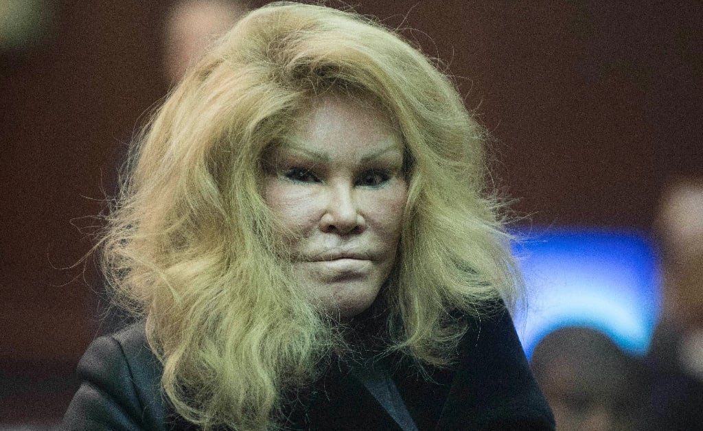 Jocelyn Wildenstein é uma socialite suíça.  Reprodução