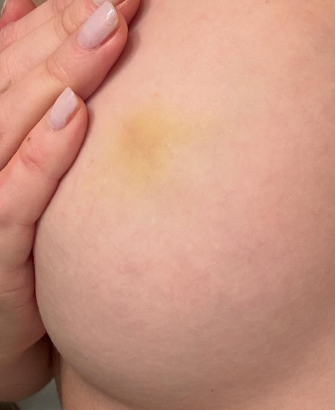 Marcela Tomaszewski postou prints e fotos de supostas agressões. Foto: Reprodução/ Instagram @tomaszewsk