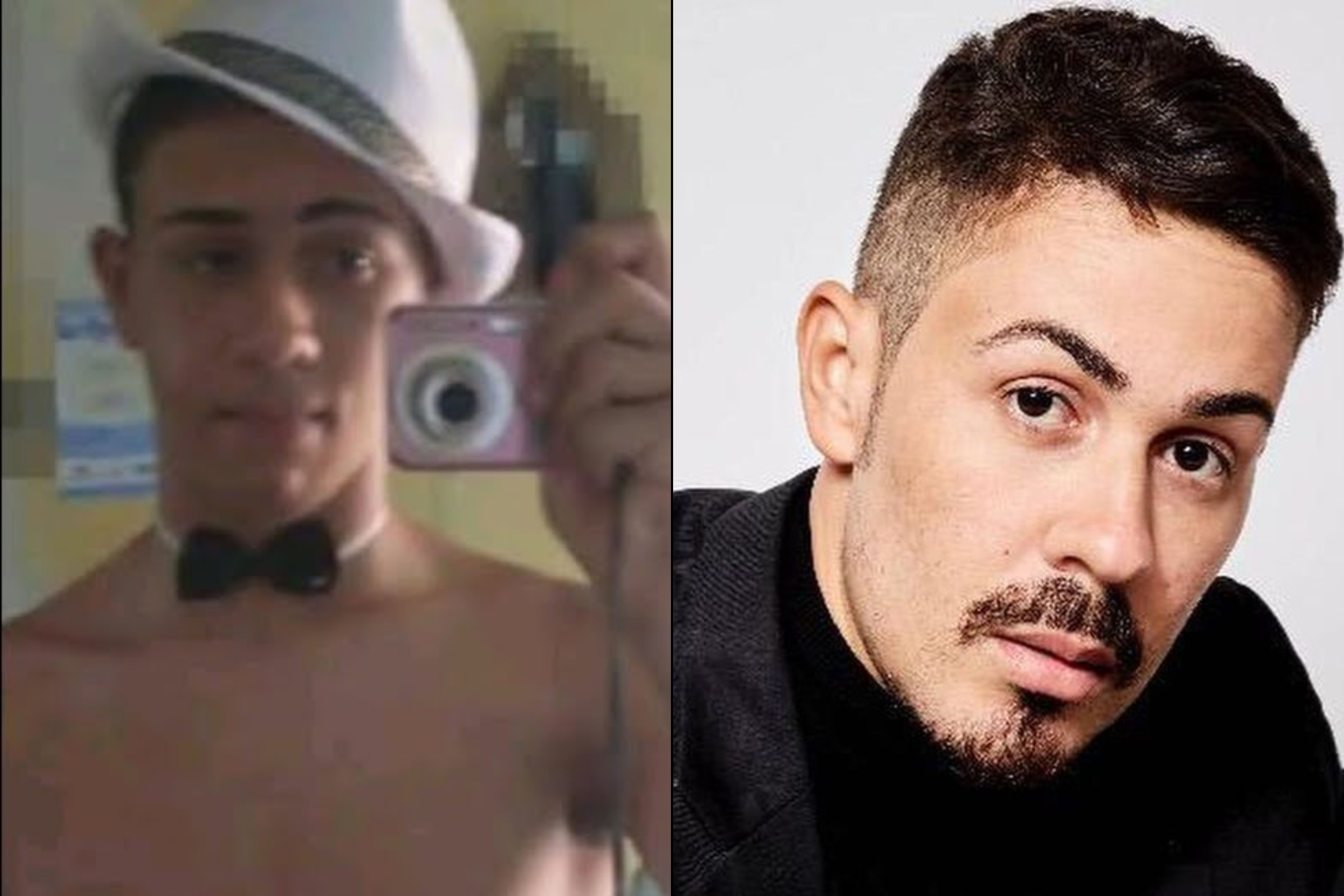 Antes e depois de Carlinhos Maia Reprodução