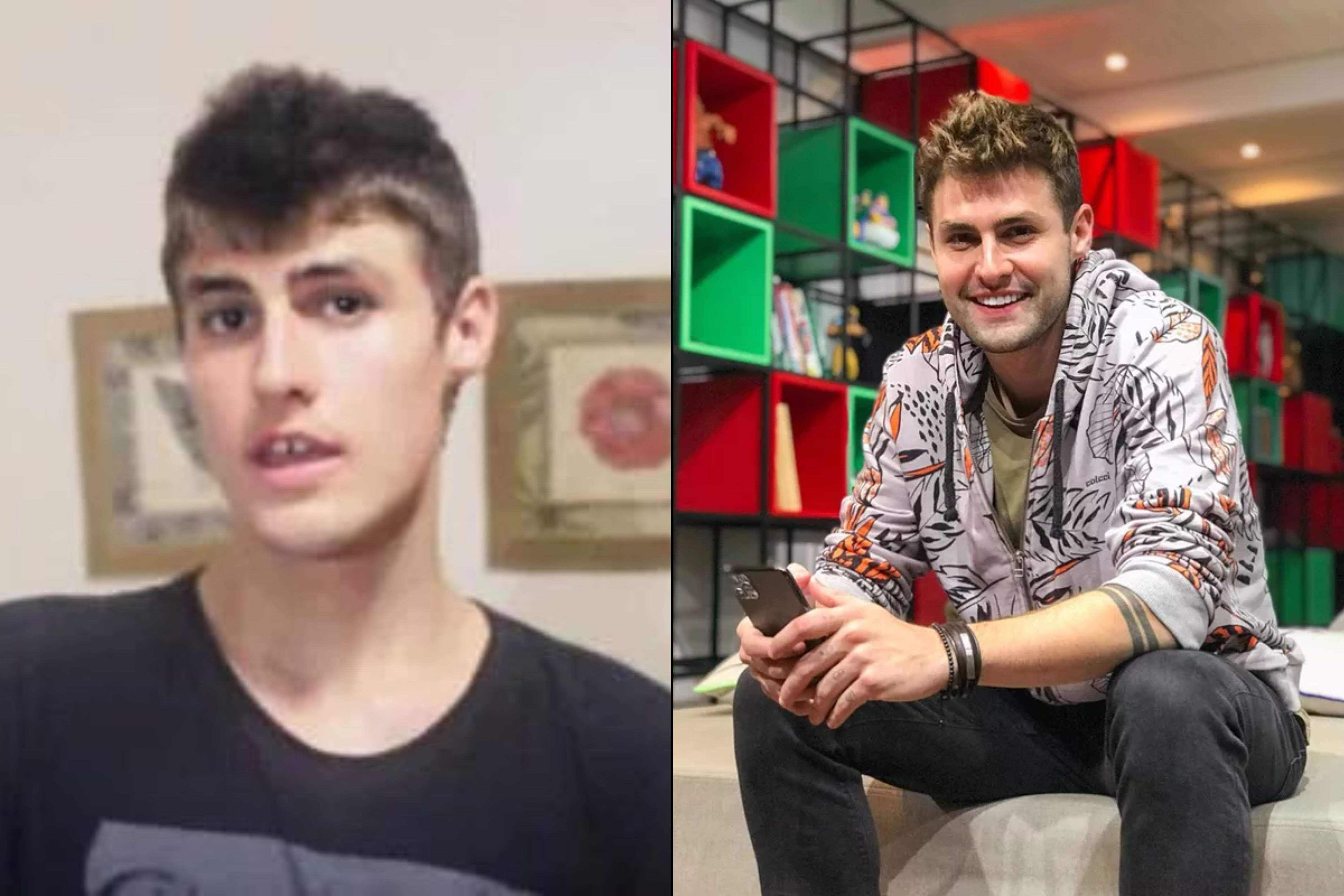 Antes e depois de Rezende Reprodução