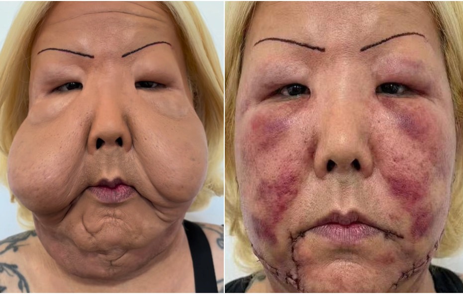 Juju do pix?. Foto: Reprodução/Instaram @drmarra