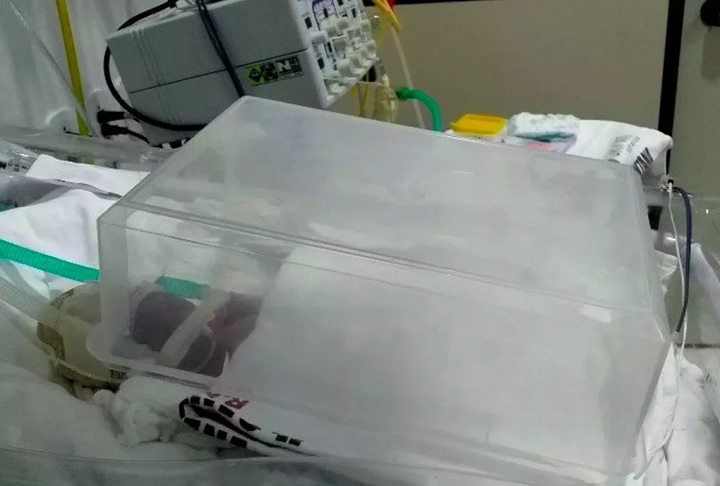 Caixa de plástico: Em 2019, no Amapá, uma bebê prematura precisou ser mantida viva com uma incubadora feita de uma caixa de plástico. Na ocasião, quatro crianças necessitavam do equipamento, mas apenas um funcionava. Reprodução: Flipar