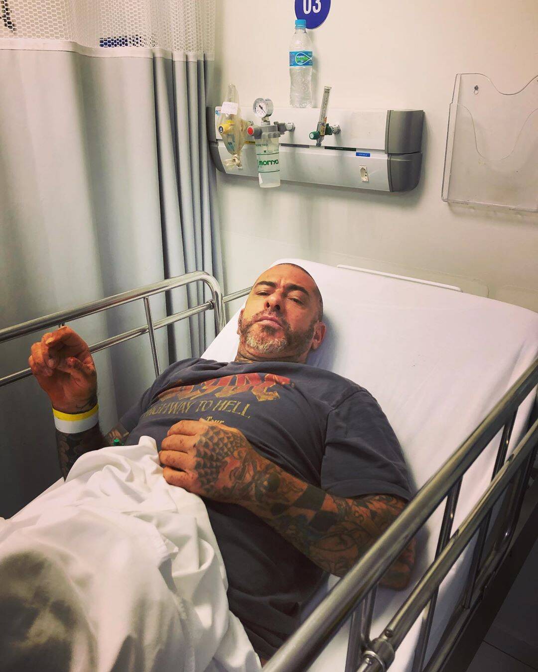 Henrique Fogaça acidentado. Foto: Reprodução / Instagram